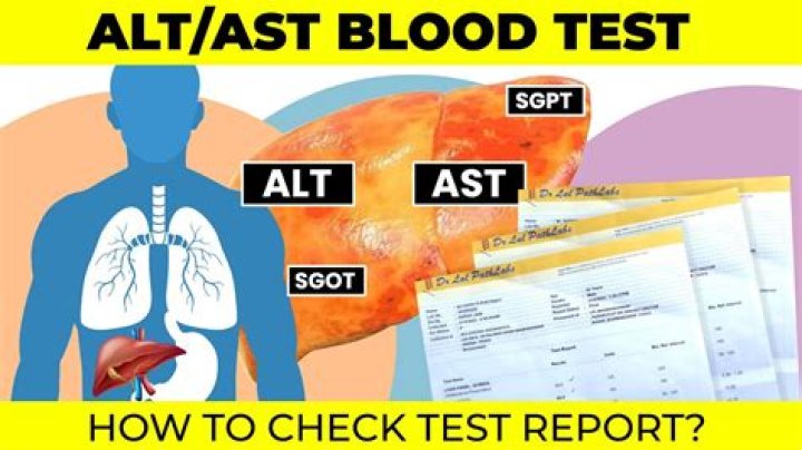 ast blood test