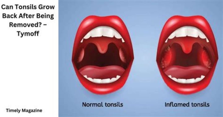 can tonsils grow back