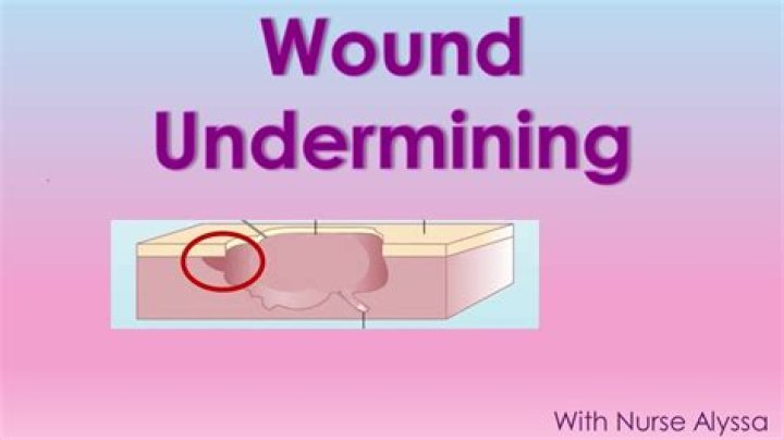 undermining meaning