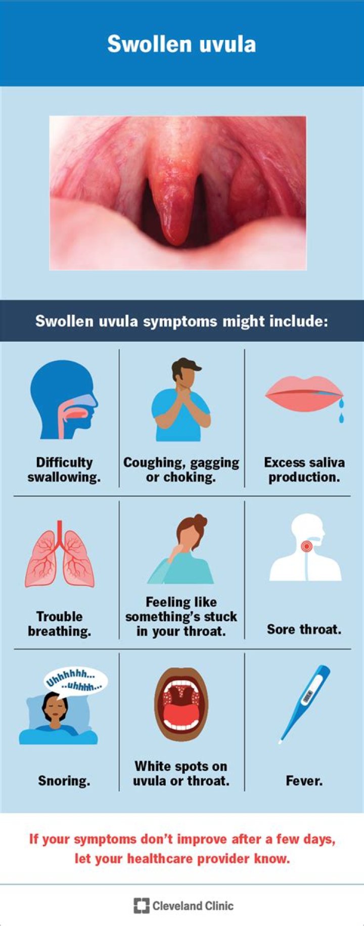 uvula swollen